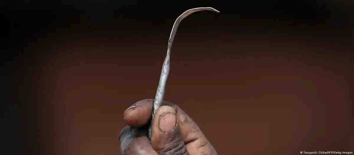 Millones sobreviven a la mutilación genital en el mundo